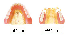 ゴールド床